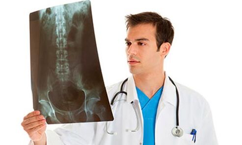 il medico guarda una radiografia per diagnosticare la lombalgia